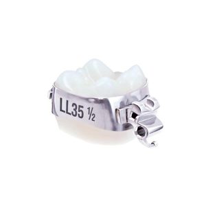 Molar Bands with Cleat